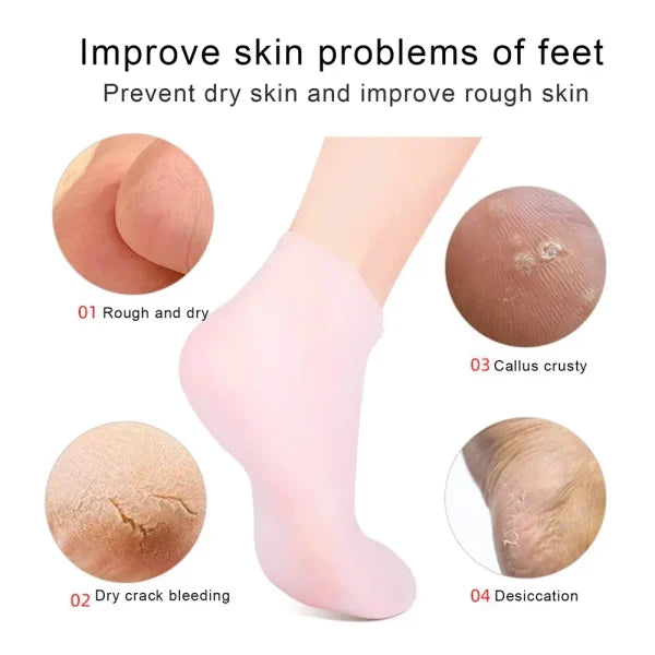 Silicone Socks Gel Moisturising Jelly Socks Foot Care Protector (Random Color)